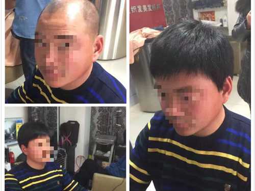 织发案例