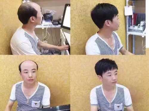 织发案例