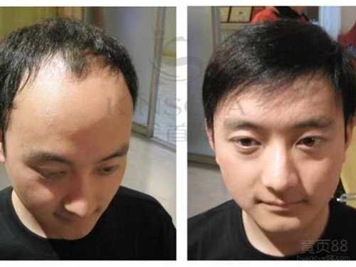 织发案例
