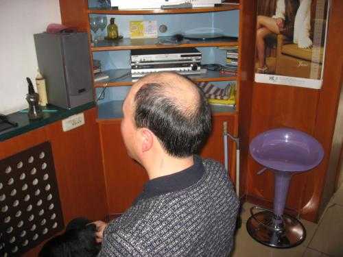 织发前