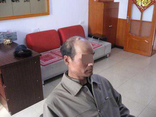 织发前
