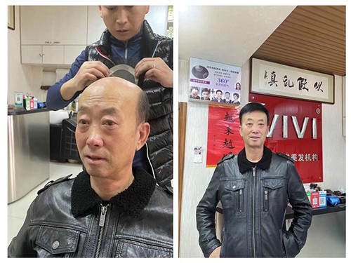 织发案例