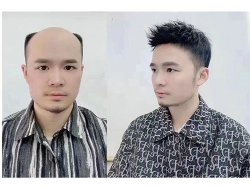 织发案例