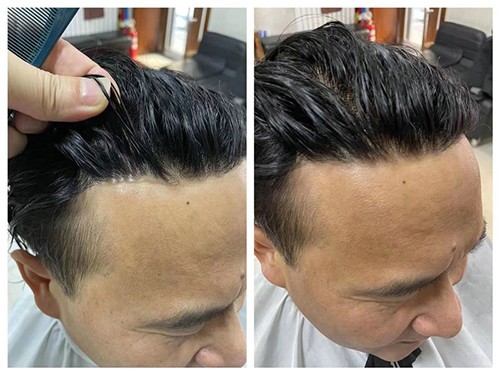 织发案例